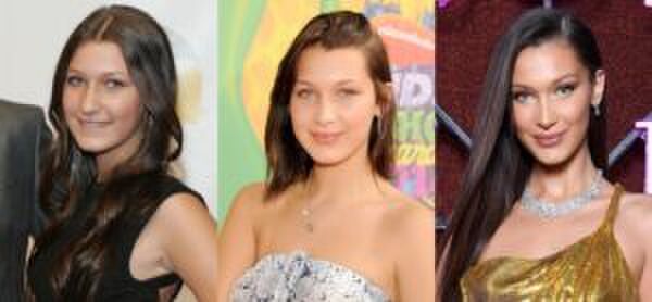 Illustratie voor: Zien: deze video bevestigt wat Bella Hadid aan plastische chirurgie heeft ondergaan