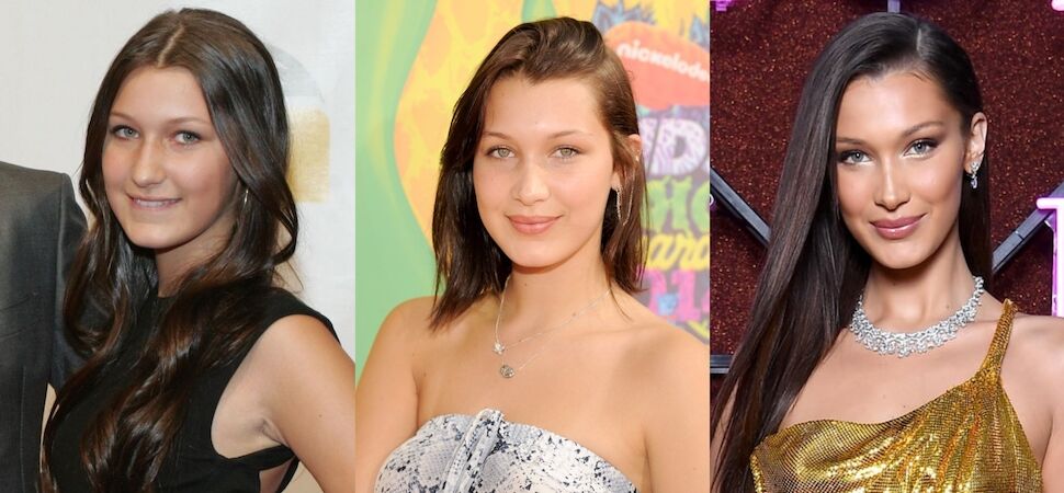 Bella Hadid plastisch chirurgie FEM FEM