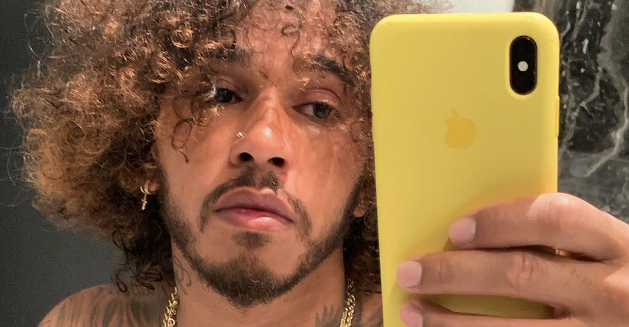 Zó zag F1-coureur Lewis Hamilton eruit voor zijn haartransplantatie