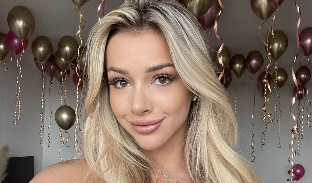 Zo zag Emma Heesters eruit voor haar fillers en botox