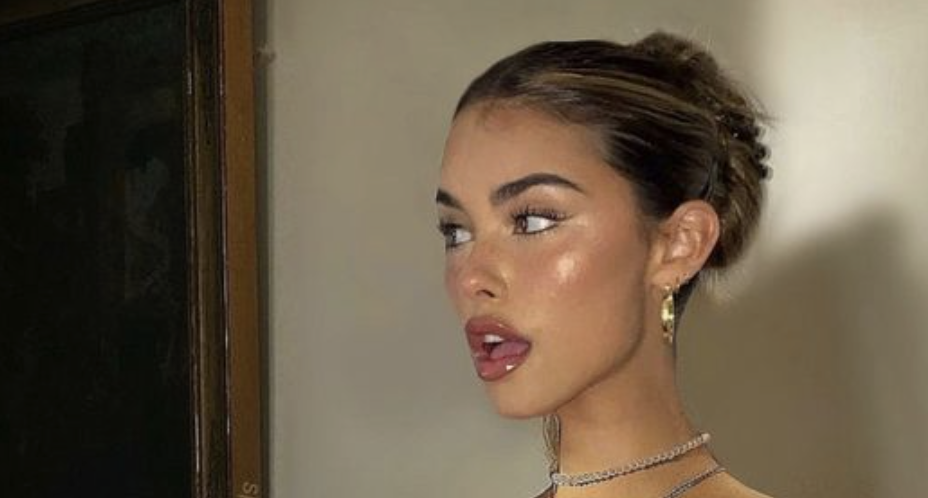 7x de leukste haarstijlen voor als je haar vet is