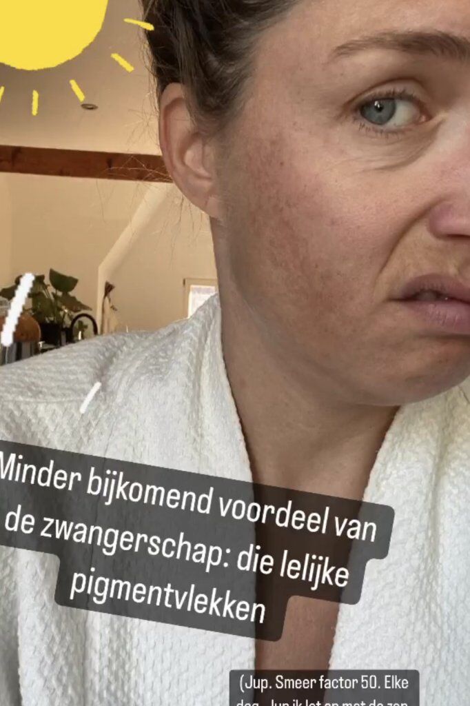 marieke elsinga pigmentvlekken