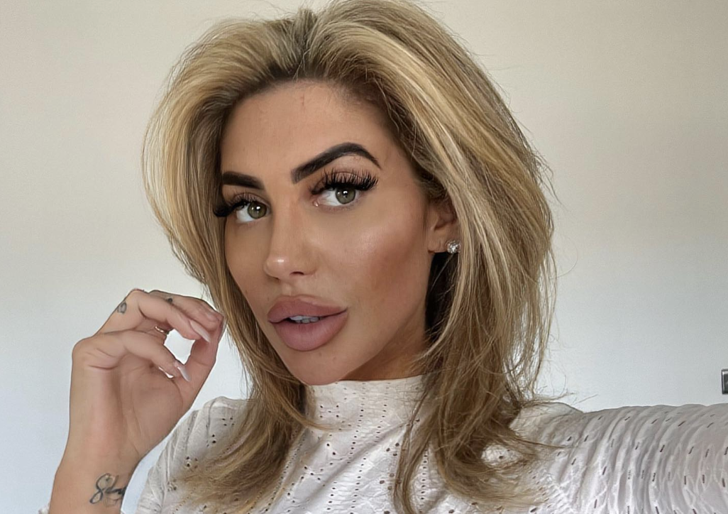 Chlo&eacute; Ferry cosmetische ingreep