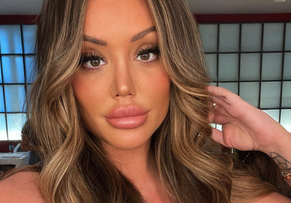 Geordie Shore Charlotte Crosby fillers lippen