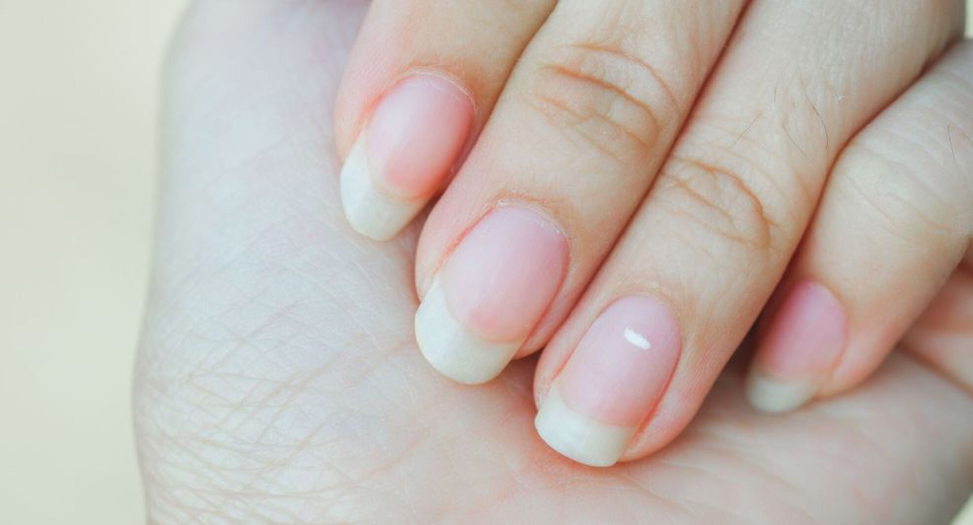 witte stipjes op je nagels