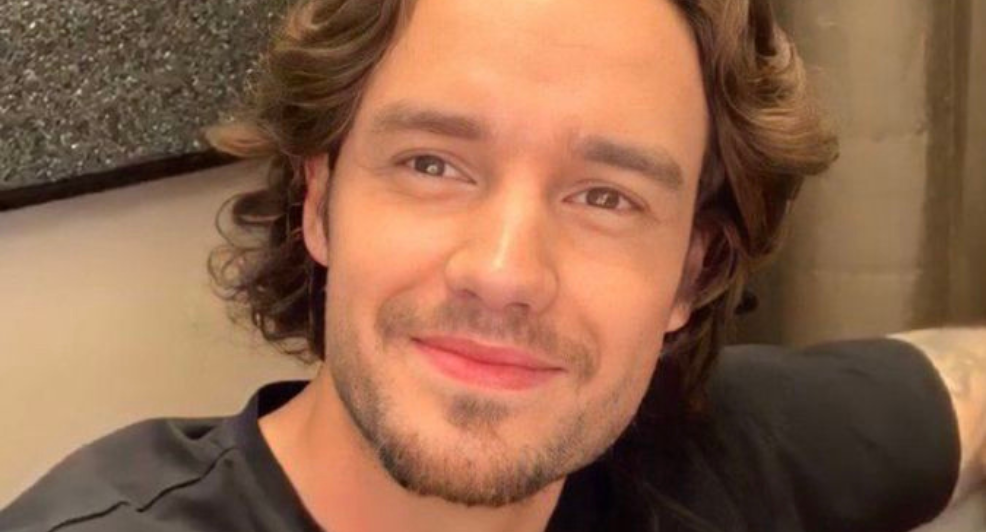 Liam Payne cosmetische ingrepen one direction