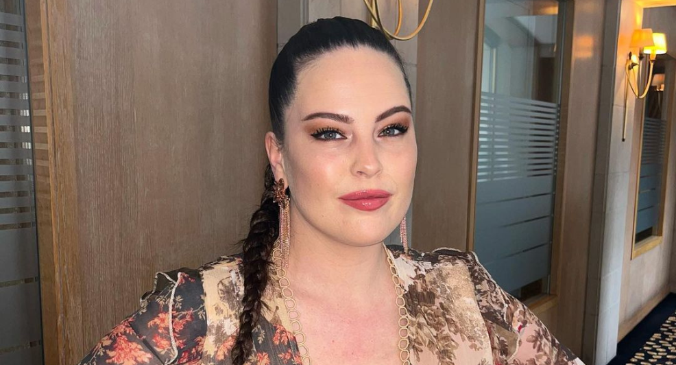 Robin Martins botox hoofd reactie Instagram