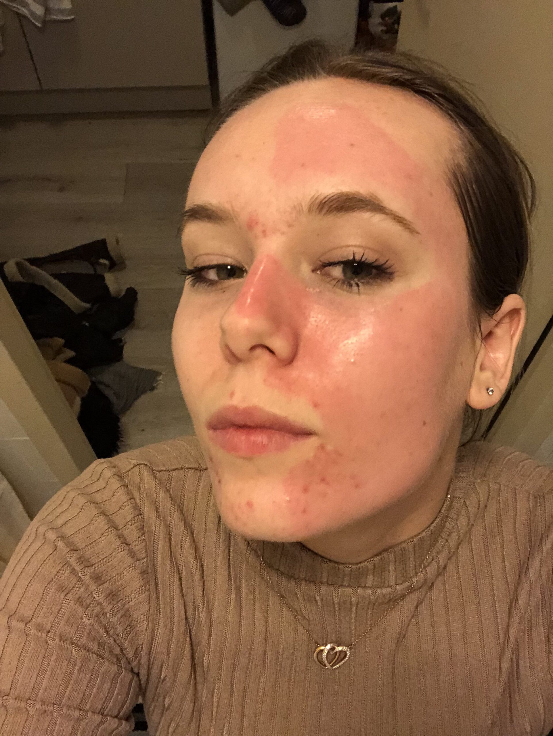 rode huid masker clay and glow julia veer