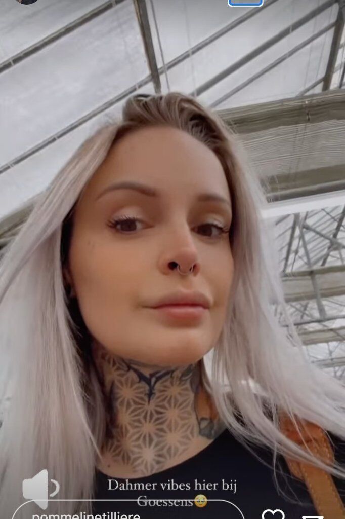 Pommeline Tillière lipfillers