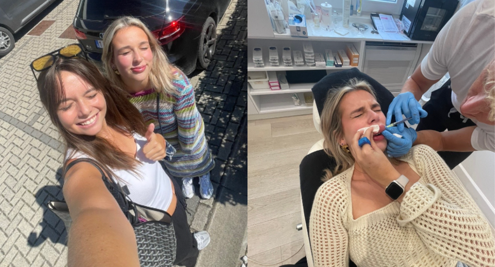 allergische reactie lipfillers tiktok