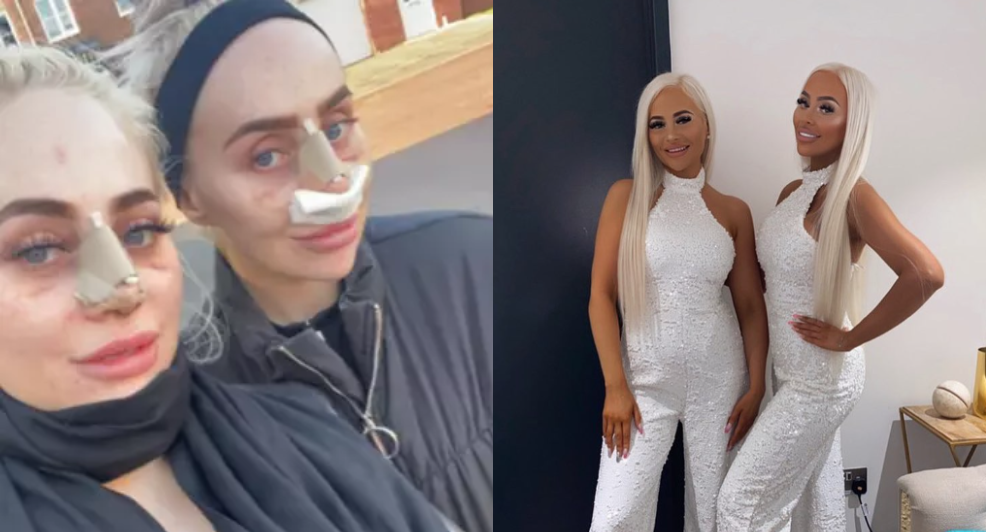 tweeling barbie lijken geld uitgeven 200.000 euro cosmetische ingrepen