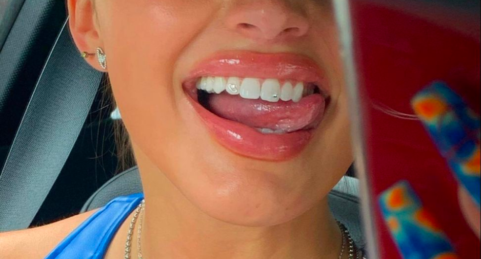 tooth gems