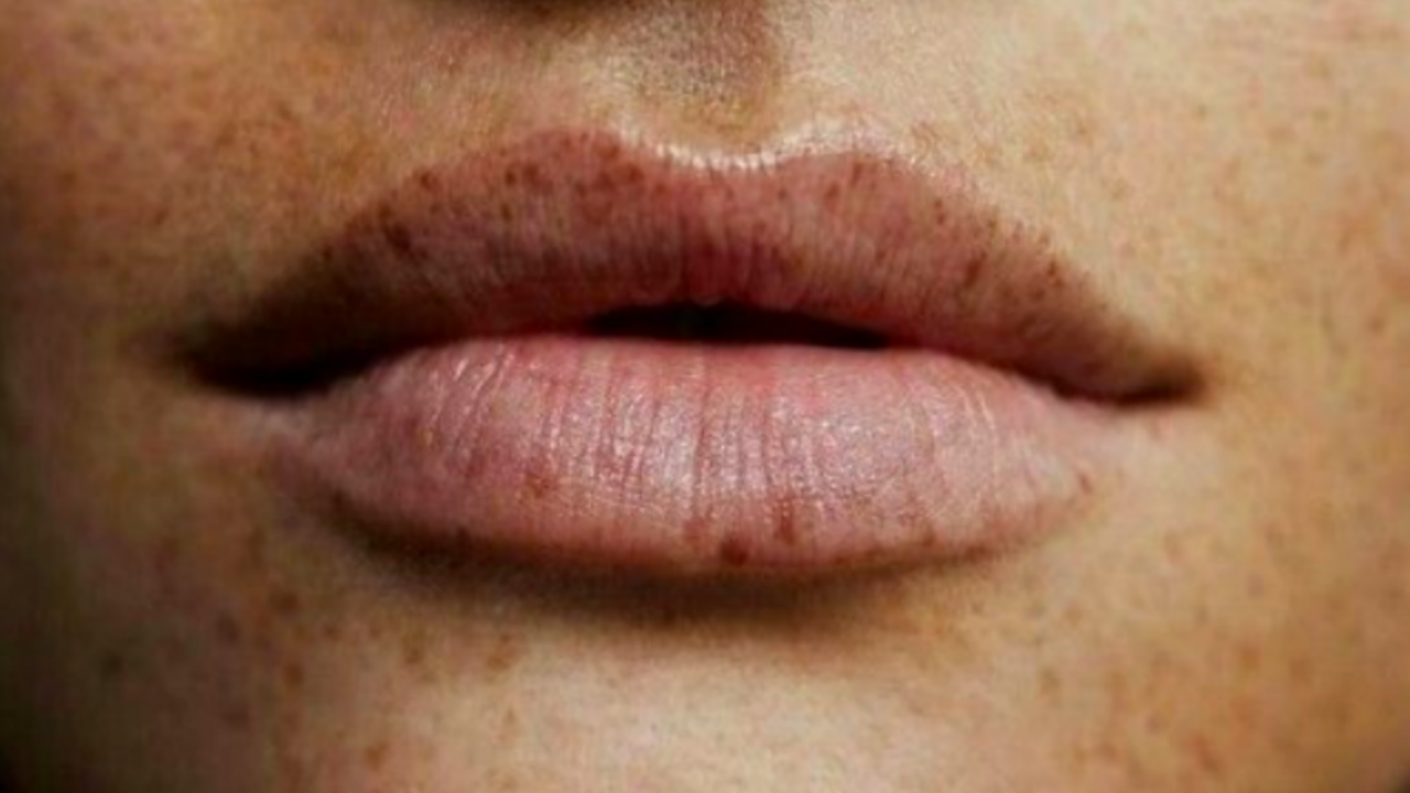 Illustratie voor: Zo zorg jij dat jouw lippen altijd kissable zijn