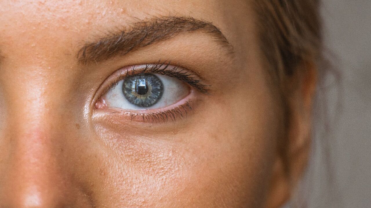 Illustratie voor: Dit wil je weten: De feiten en fabels over acne
