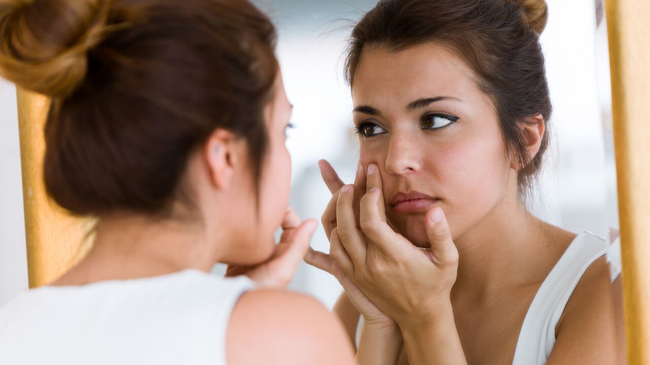 Illustratie voor: Dit zijn de meest voorkomende soorten acne + wat je eraan kunt doen