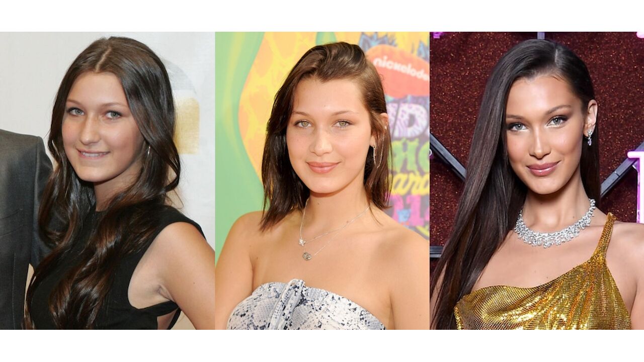 Illustratie voor: Zien: deze video bevestigt wat Bella Hadid aan plastische chirurgie heeft ondergaan