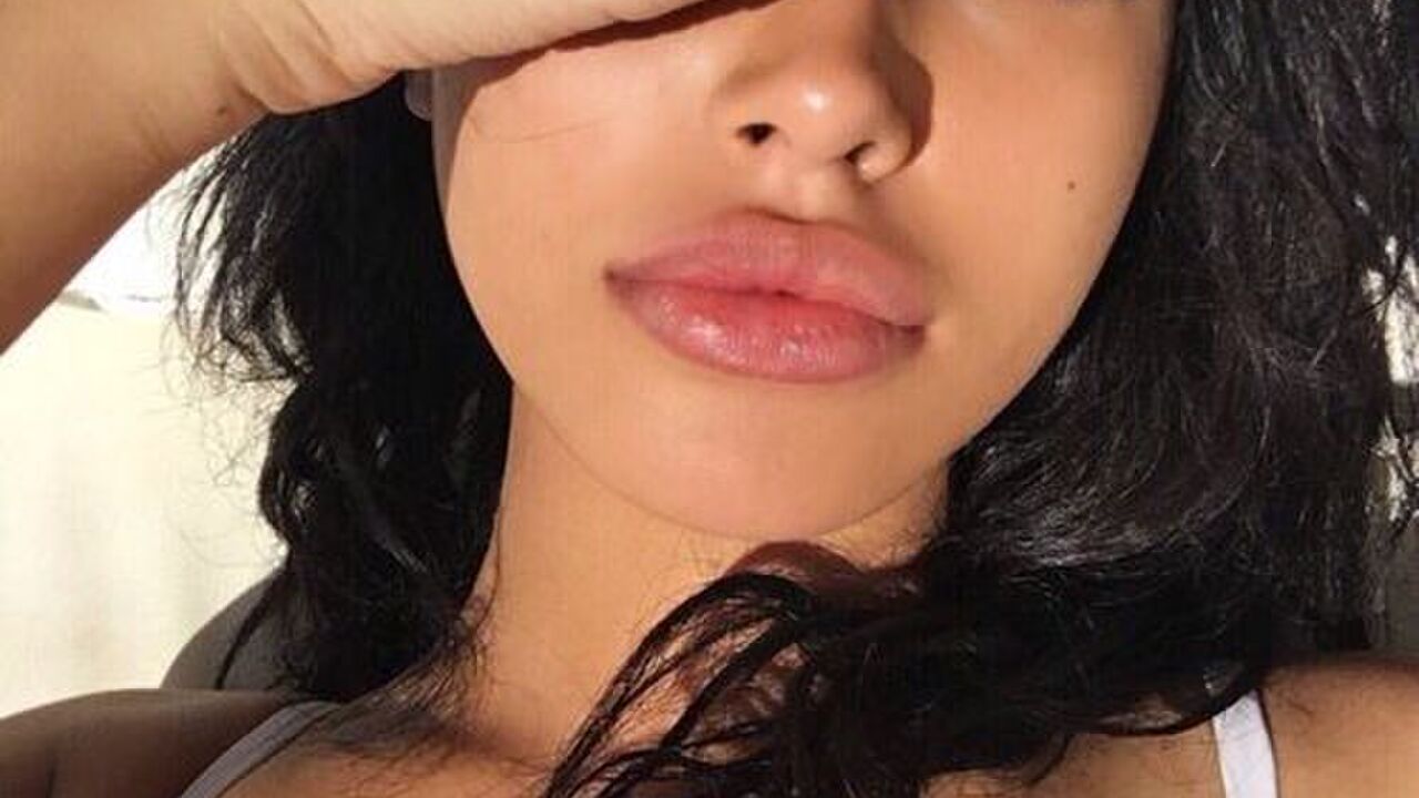 Illustratie voor: Last van droge lippen? Dit is wat je moet doen!