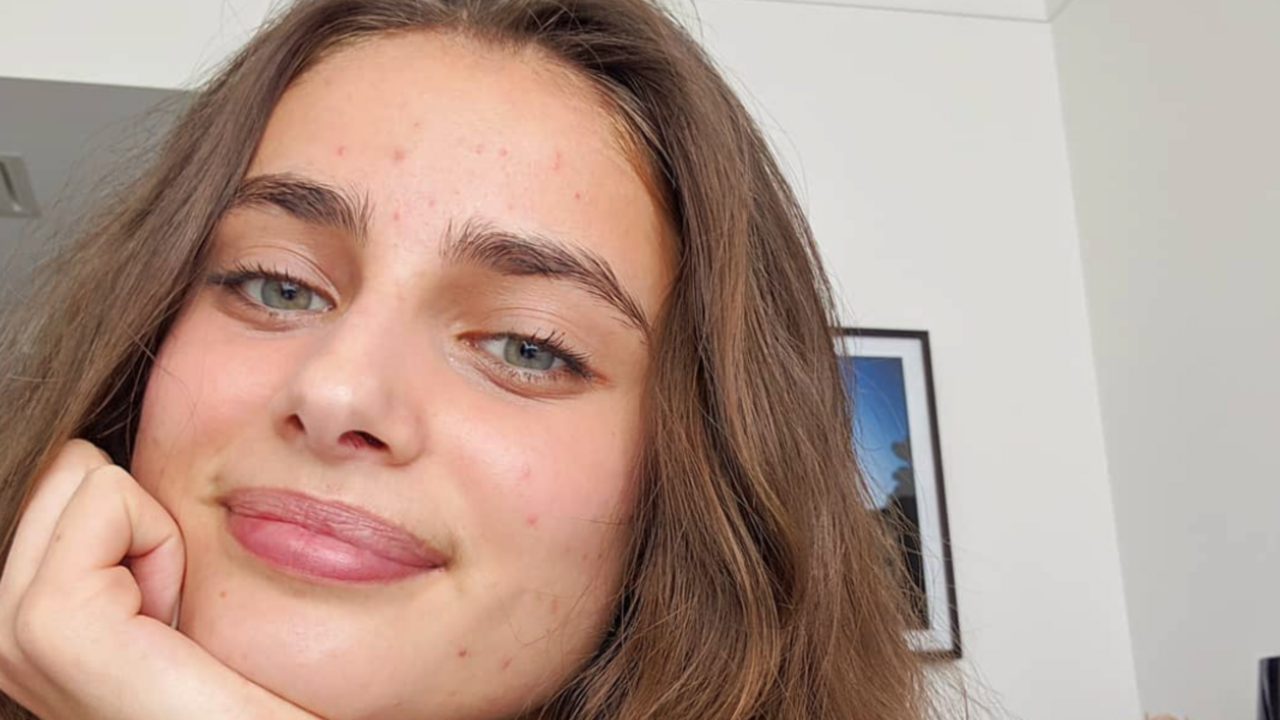 Illustratie voor: Let’s get real: deze celebs struggelen met acne