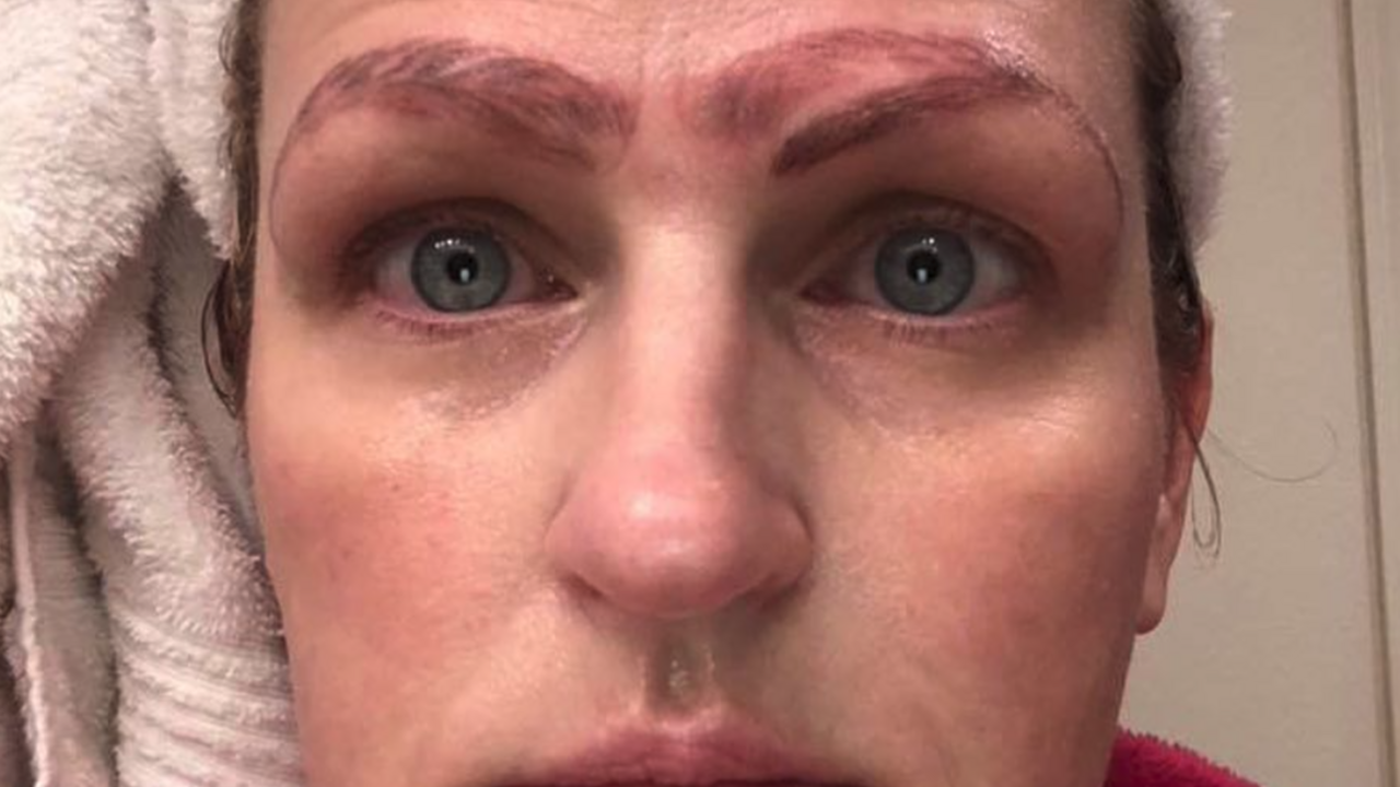 Illustratie voor: Oh no: microblading-behandeling gaat compleet fout
