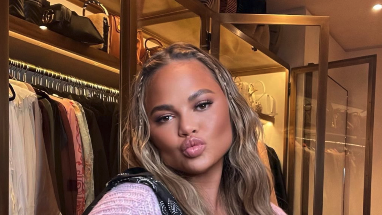 Illustratie voor: Chrissy Teigen deelt before- en afterfoto’s van wenkbrauw transplantatie