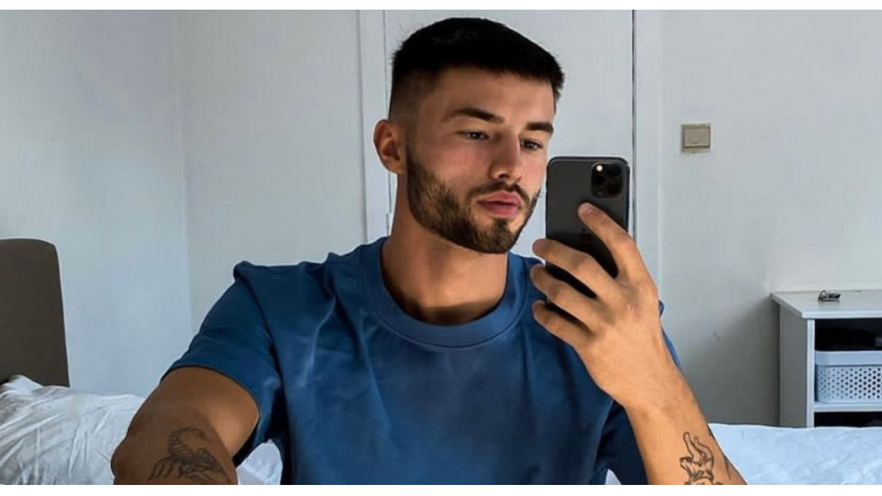 Love Island Lennert haartransplantatie