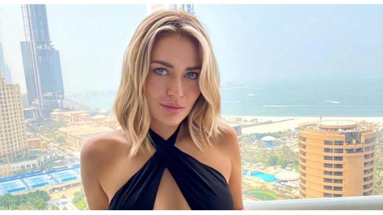 Temptation Island Megan botox fillers