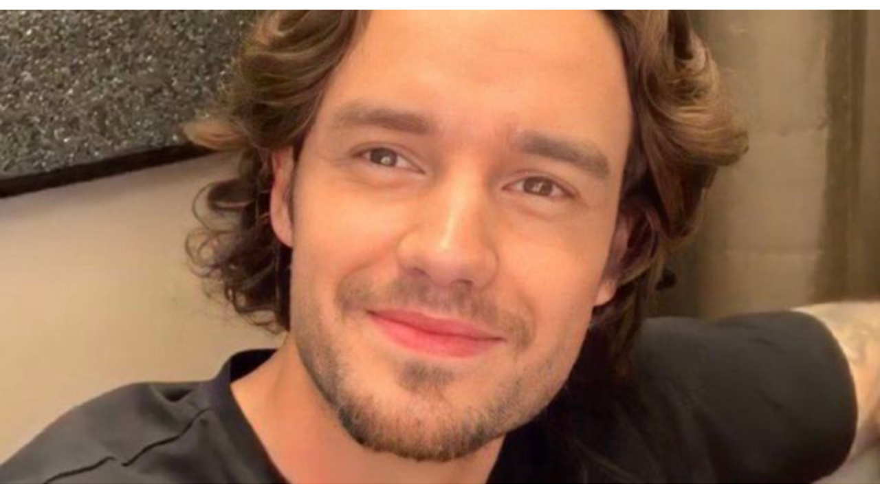 Liam Payne cosmetische ingrepen one direction