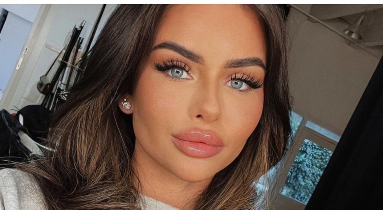 Sarah van Soelen afscheid lipfillers plastische chirurgie