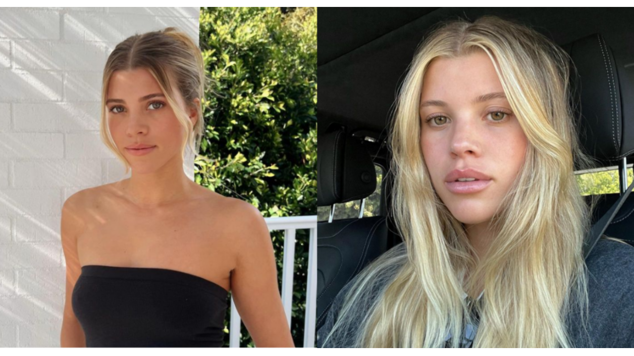 scandi Scandinavische hairline haarlijn trend tiktok sophia richie