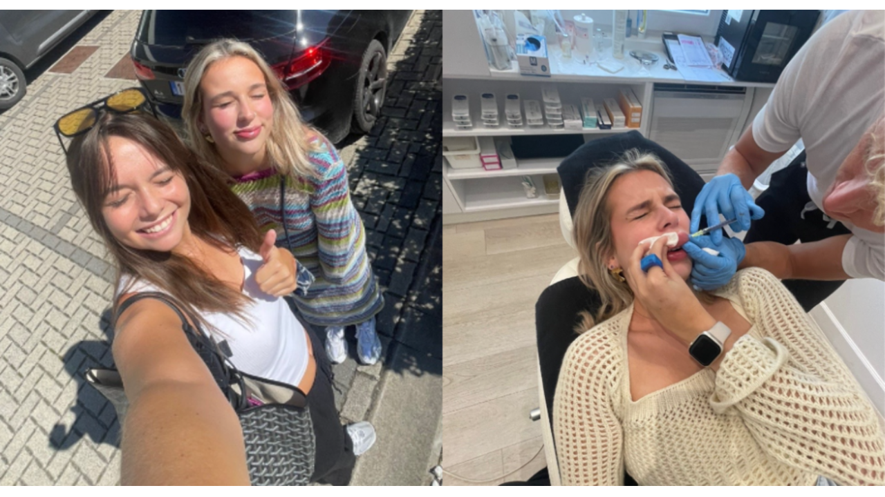 allergische reactie lipfillers tiktok