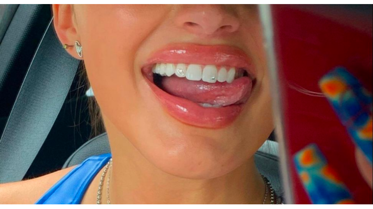 tooth gems