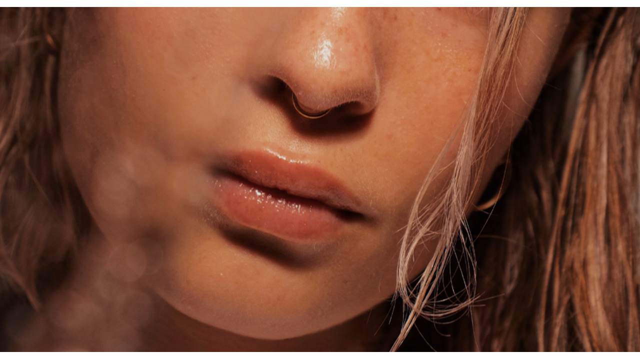 lip filler botox
