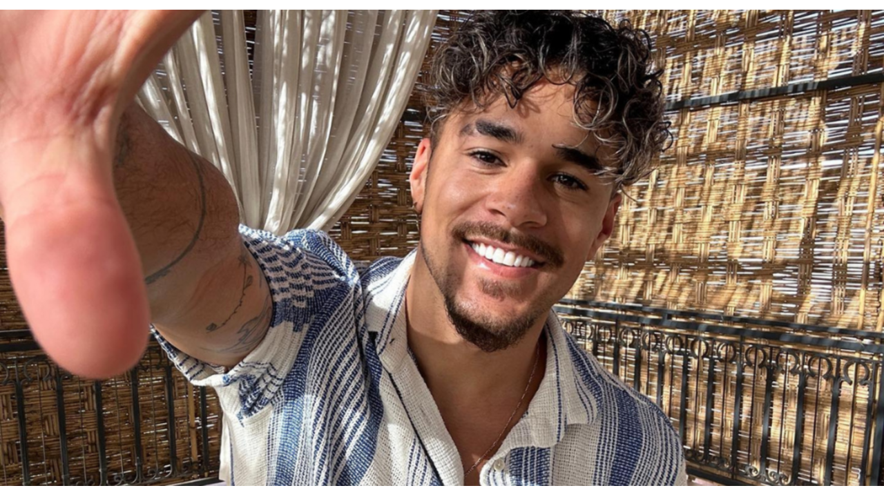 mattheus-love-island-haartransplantatie
