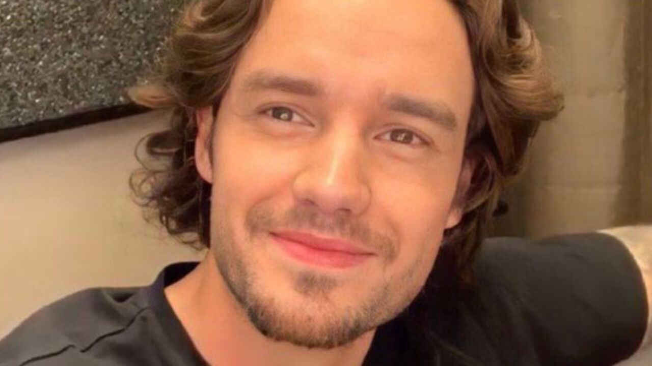 Liam Payne cosmetische ingrepen one direction