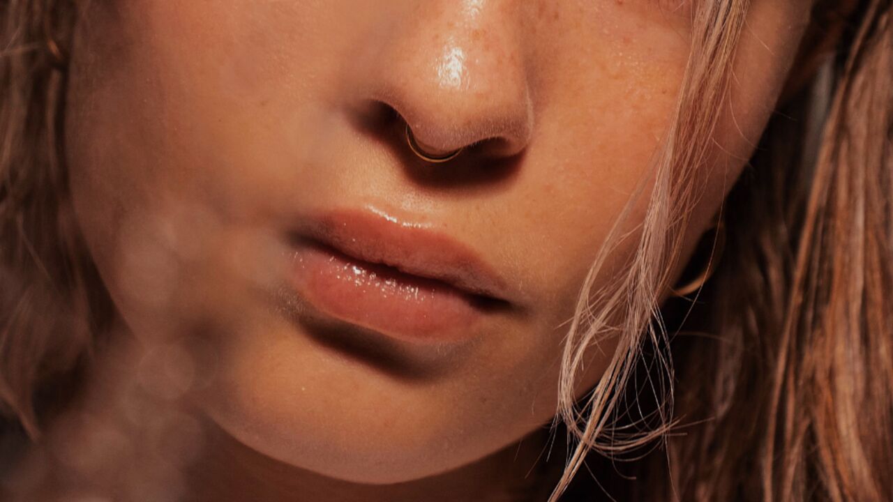 lip filler botox