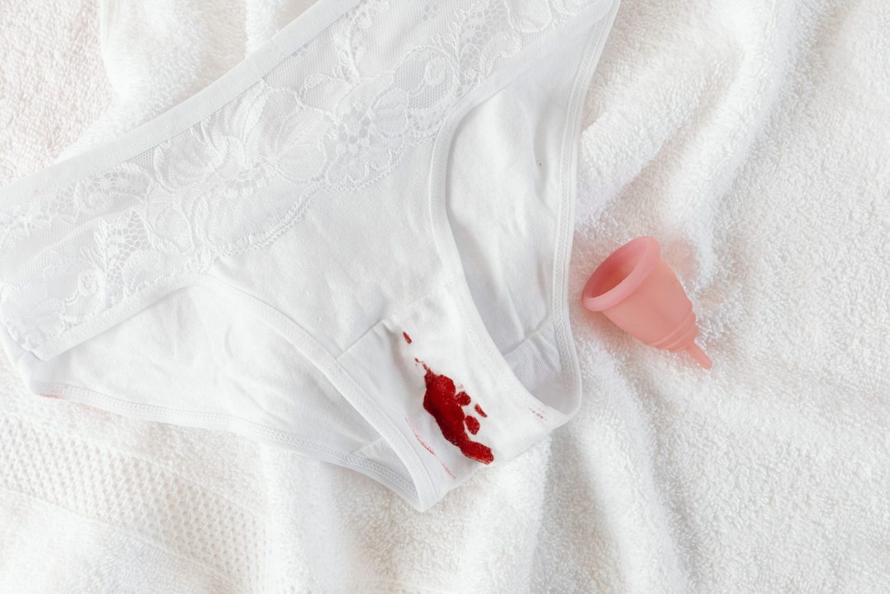 Free bleeding