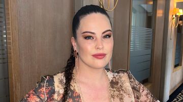 Robin Martins botox reactie Instagram