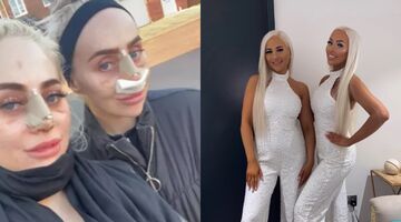 tweeling barbie lijken geld uitgeven 200.000 euro cosmetische ingrepen