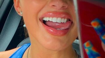 tooth gems