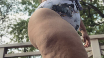 wat vinden mannen van cellulitis