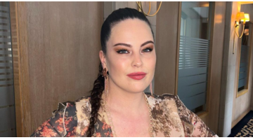 Robin Martins botox reactie Instagram