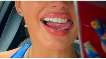 tooth gems