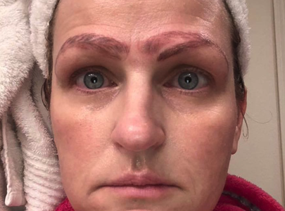 Illustratie voor: Oh no: microblading-behandeling gaat compleet fout