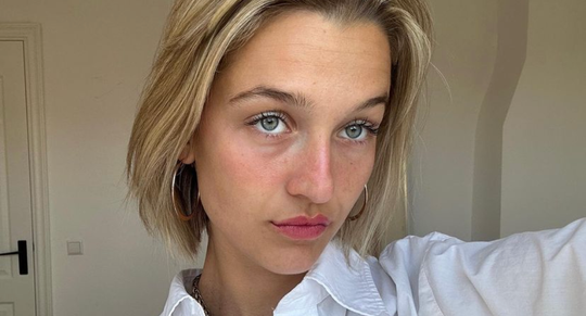 Lip combinatie natural lipfillers Lisa Korver