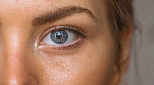 Illustratie voor: Dit wil je weten: De feiten en fabels over acne