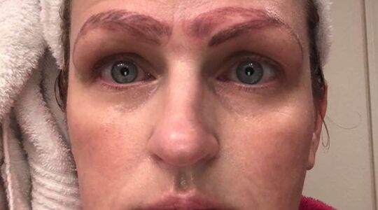 Illustratie voor: Oh no: microblading-behandeling gaat compleet fout