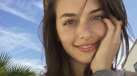 sproeten op je gezicht