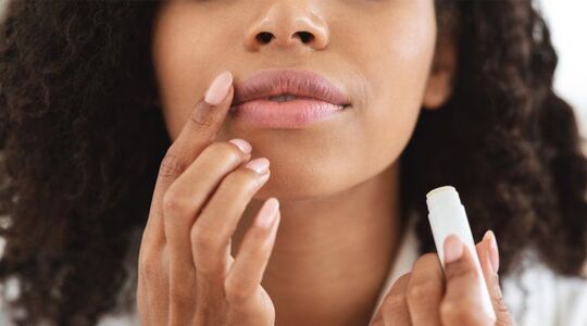 wondermiddel tegen droge lippen