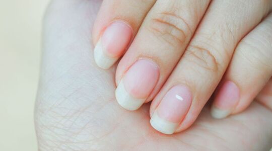 witte stipjes op je nagels