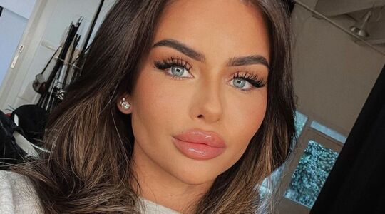 Sarah van Soelen afscheid lipfillers plastische chirurgie